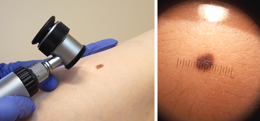 Dermatološki posegi