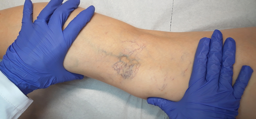 Dermatološki pregledi