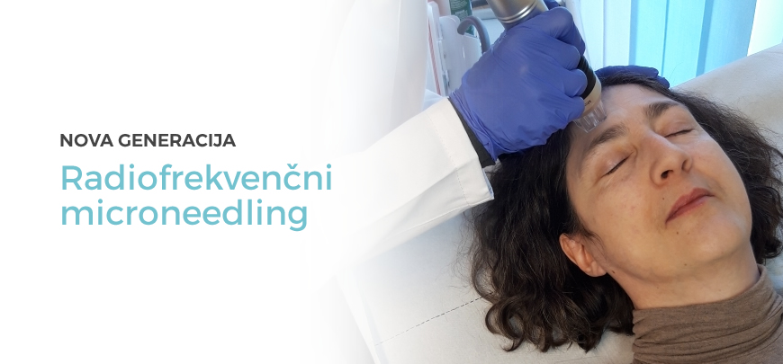 Radiofrekvenčni microneedeling