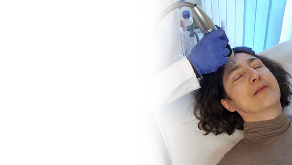 Radiofrekvenčni microneedeling nove generacije